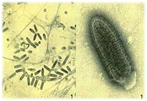 Vacuna contra la rabia