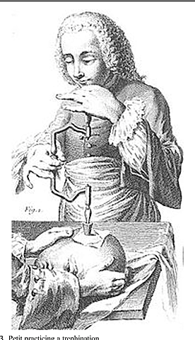 La principal aportación original de Pott.