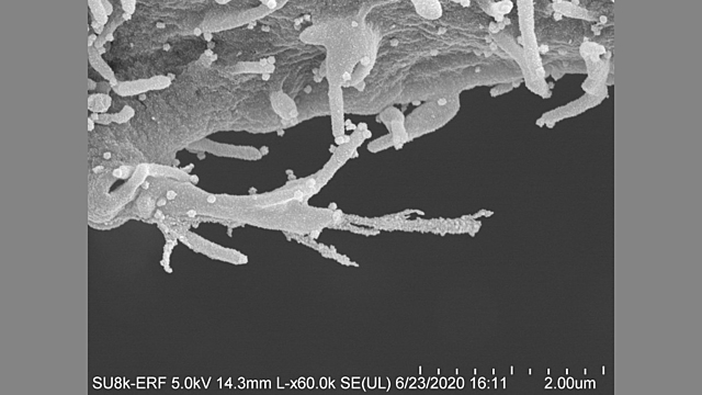 Cells infected with COVID-19 seen to sprout tentacles.