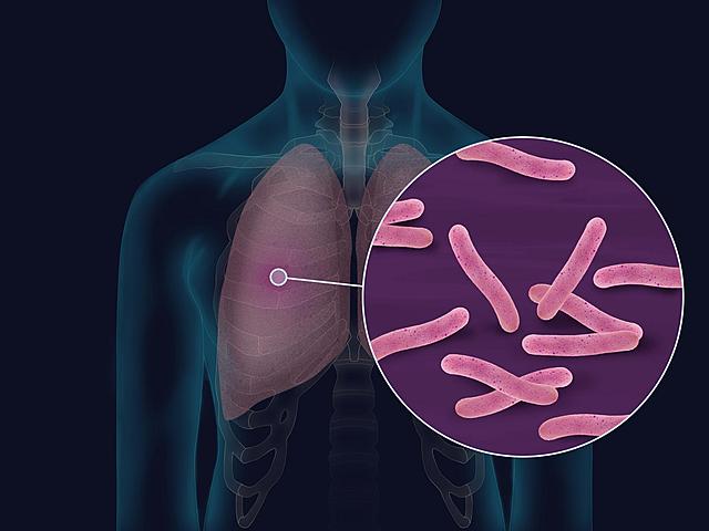 Inmunidad contra la tuberculosis