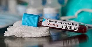 SE CONFIRMA NUEVO CORONAVIRUS