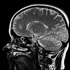 Resonancia Magnética Nuclear