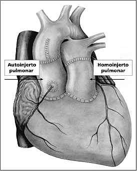Dr. Donald Ross (1922-2014)