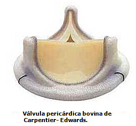 Válvulas Pericárdicas Bovinas
