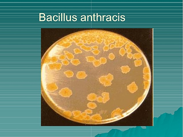 Bacillus anthracis