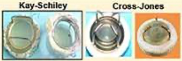 PROTESIS MECANICA JAULA-DISCO