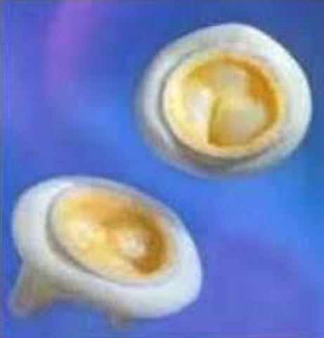 VALVUAL BIOLOGICA PORCINA