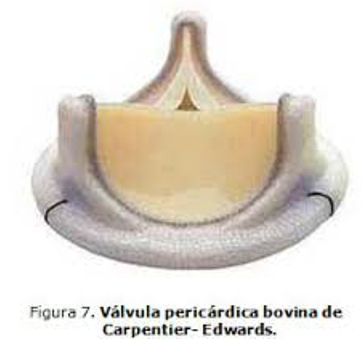 PROTESIS BIOLOGICA BOVINA