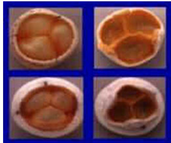PROTESIS BIOLOGICAS SIN SOPORTE