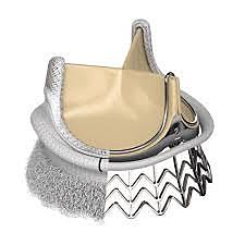 Edwards Lifesciences