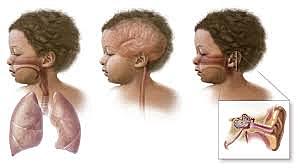 Esquema de vacunación incluye 13 enfermedades (2)