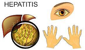 Vacunación de niños en estancias y guarderías (2)