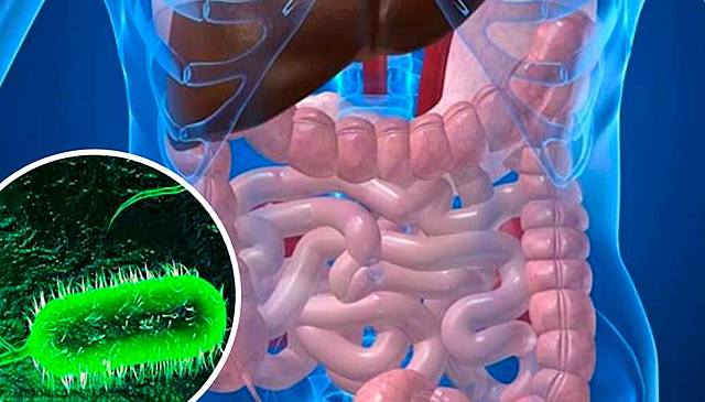 DESCUBRIMIENTO DE LA CURA DEL  COLERA