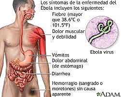 ¿ HABRA VACUNA PARA EL EBOLA?