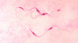 Timeline: Historia Parasitologia