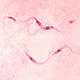 Trypanosoma cruzi crithidia