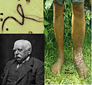 PATRICK MANSON año 1877-1778