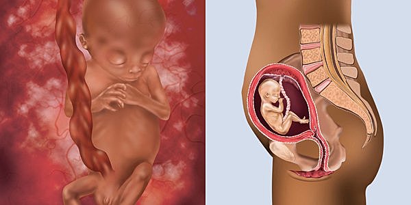 Important Milestone #3 (12 Weeks)