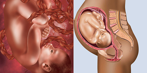 Important Milestone #1 (34 Weeks)