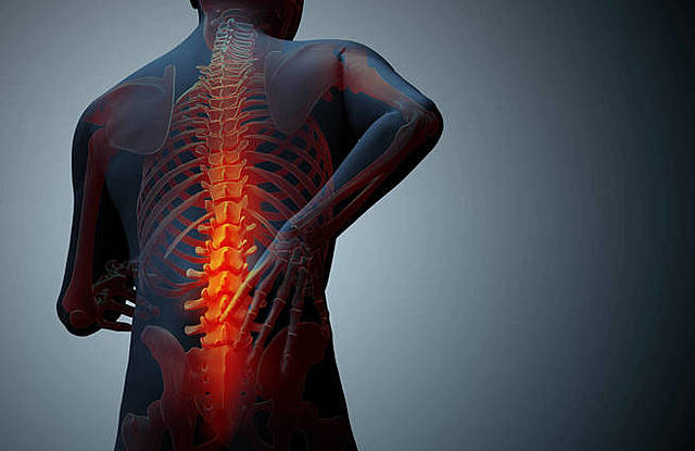 Cuando me cayo un saco de arroz en la espalda