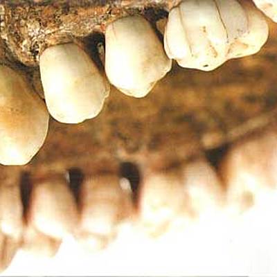 Timeline: HISTORIA DE LA ODONTOLOGÍA FORENSE/ALEJANDRA ROSSI