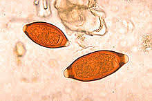 Trichuris trichuria y Ascaris lumbricoide