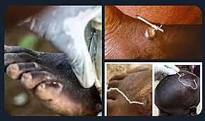 Dracunculus Medinensis