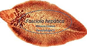 Fasciola hepática