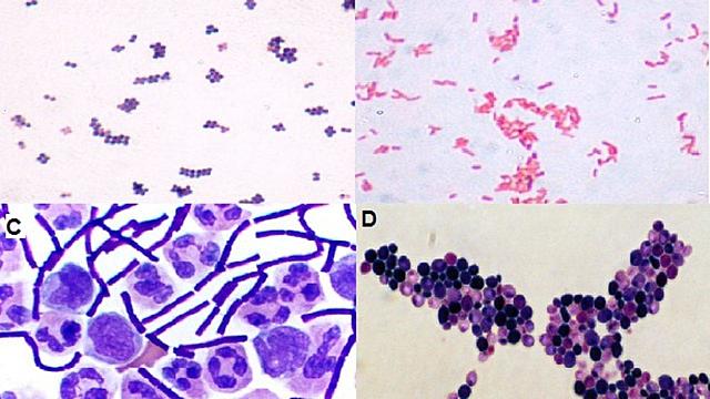 TÉCNICA DE TINCION GRAM