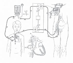 C. W. Lillehei realiza su técnica de circulación cruzada