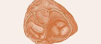 Dr. Harken realiza la primera sustitución valvular aórtica por una prótesis de bola tipo “cage ball”