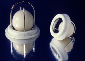 Starr y Edwards idearon una nueva prótesis consistente en una bola de plástico (silastic) encerrada en una armadura de vitalio