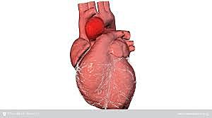 En el Hospital de la Universidad Católica de Chile se realizó la primera reparación de un aneurisma ventricular post-infarto y una comunicación interventricular post-infarto en nuestro país
