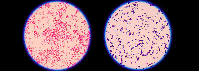 TECNICA DE TINCIÓN DE GRAM