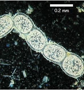 Thiomargarita Namibiensis