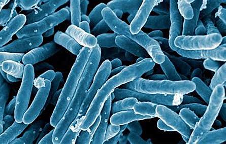 Mycobacterium