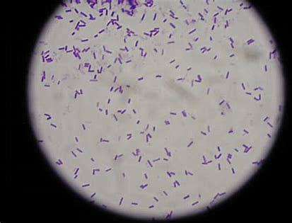 Bacillus Subtilis