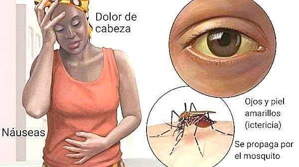 FIEBRA AMARILLA:TRATAMIENTO.