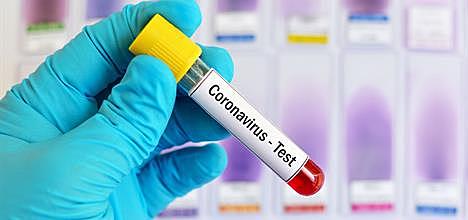 Desarrollo de pruebas de diagnostico