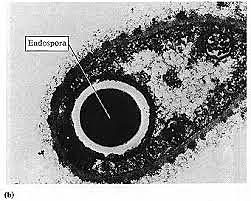 Endosporas