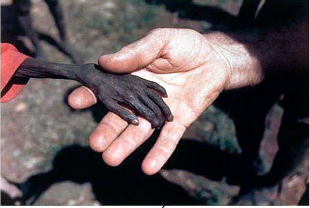Hambrunas en África.  La imagen de la muerte.