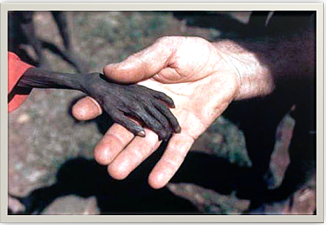 : Hambrunas en África.  La imagen de la muerte.