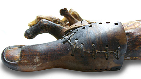 Earliest known Prosthetic Device