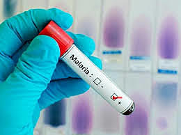 Vacuna contra la Malaria