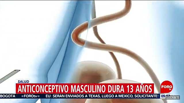 INYECCION ANTICONCEPTIVA MASCULINA