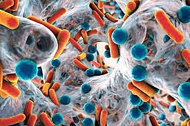 Microorganismo extremo