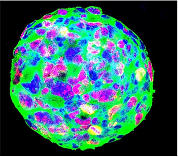 Identificación de proteína