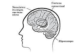 Sistema Conexionista