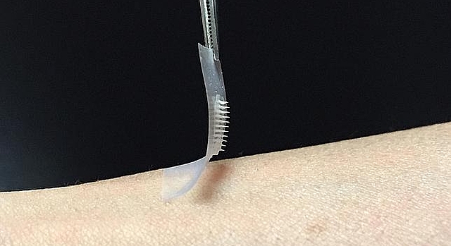 Parche inteligente de insulina