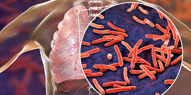 MICROORGANISMOS DE LA TUBERCULOSIS